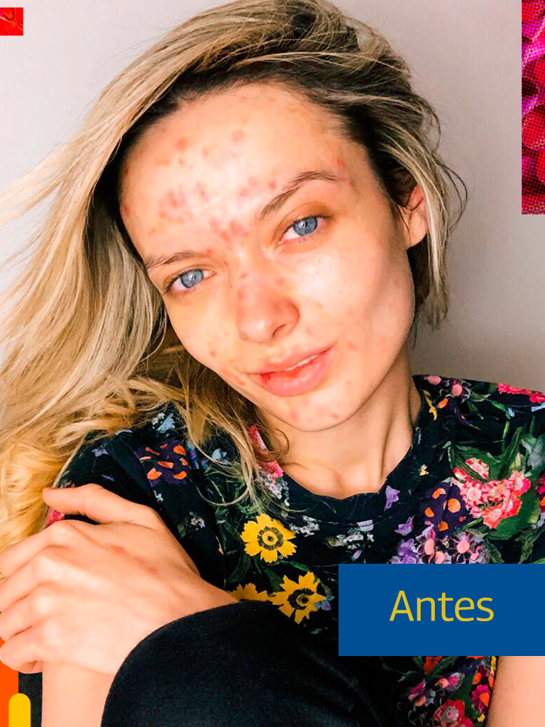 Mulher Antes